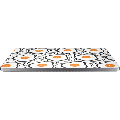 Bouffants and Broken Hearts Eggs Universal Laptop 15in (12.2 x 8.8in) Skin